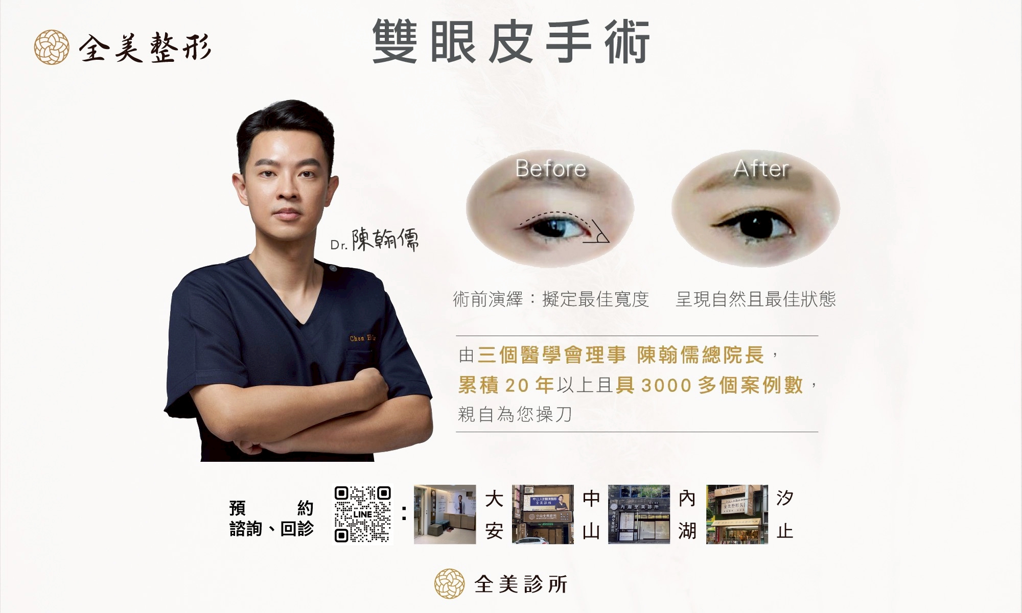 LINE_ALBUM_縫雙眼皮提眼肌手術_250817_12