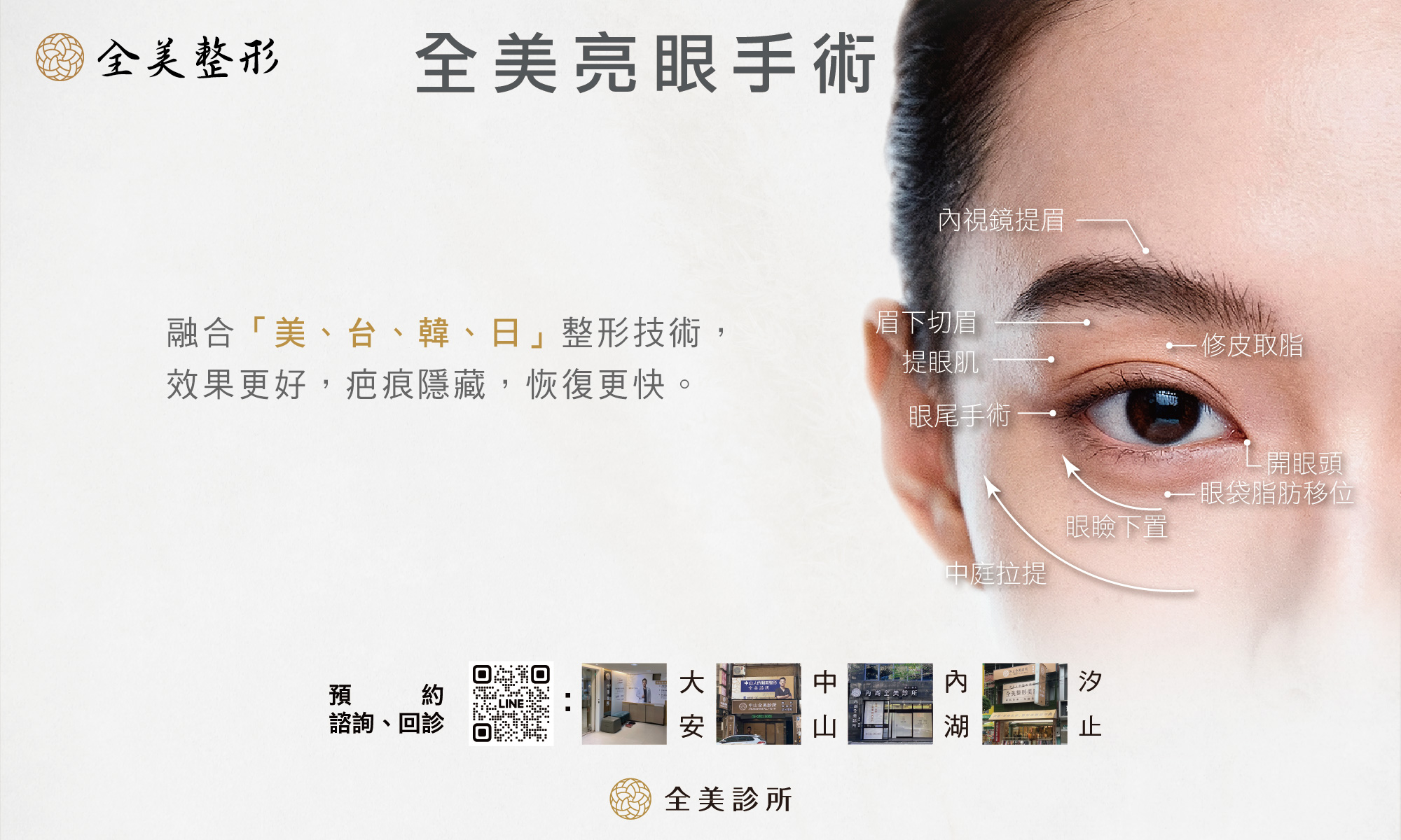 全美亮眼手術-11