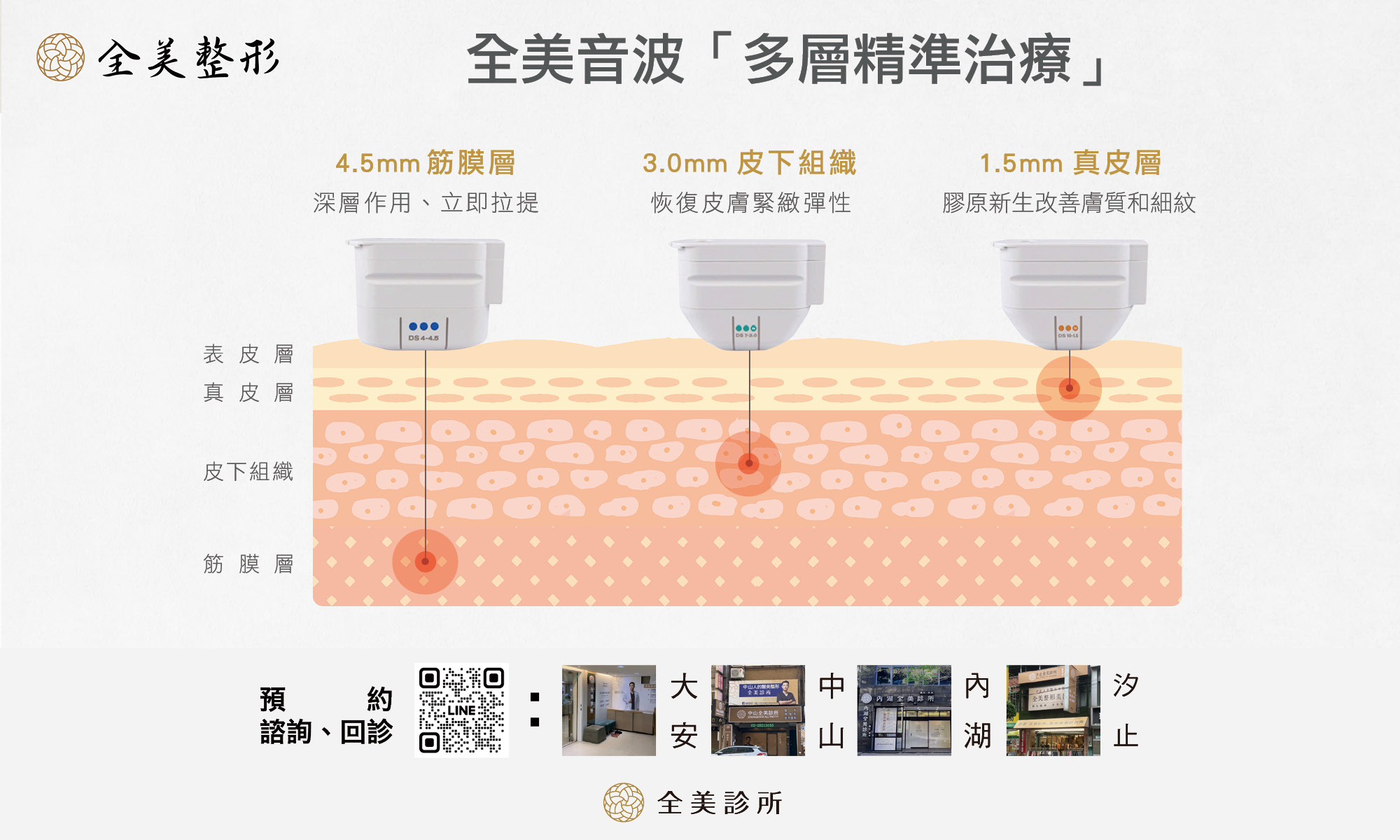 全美音波多層精準治療2