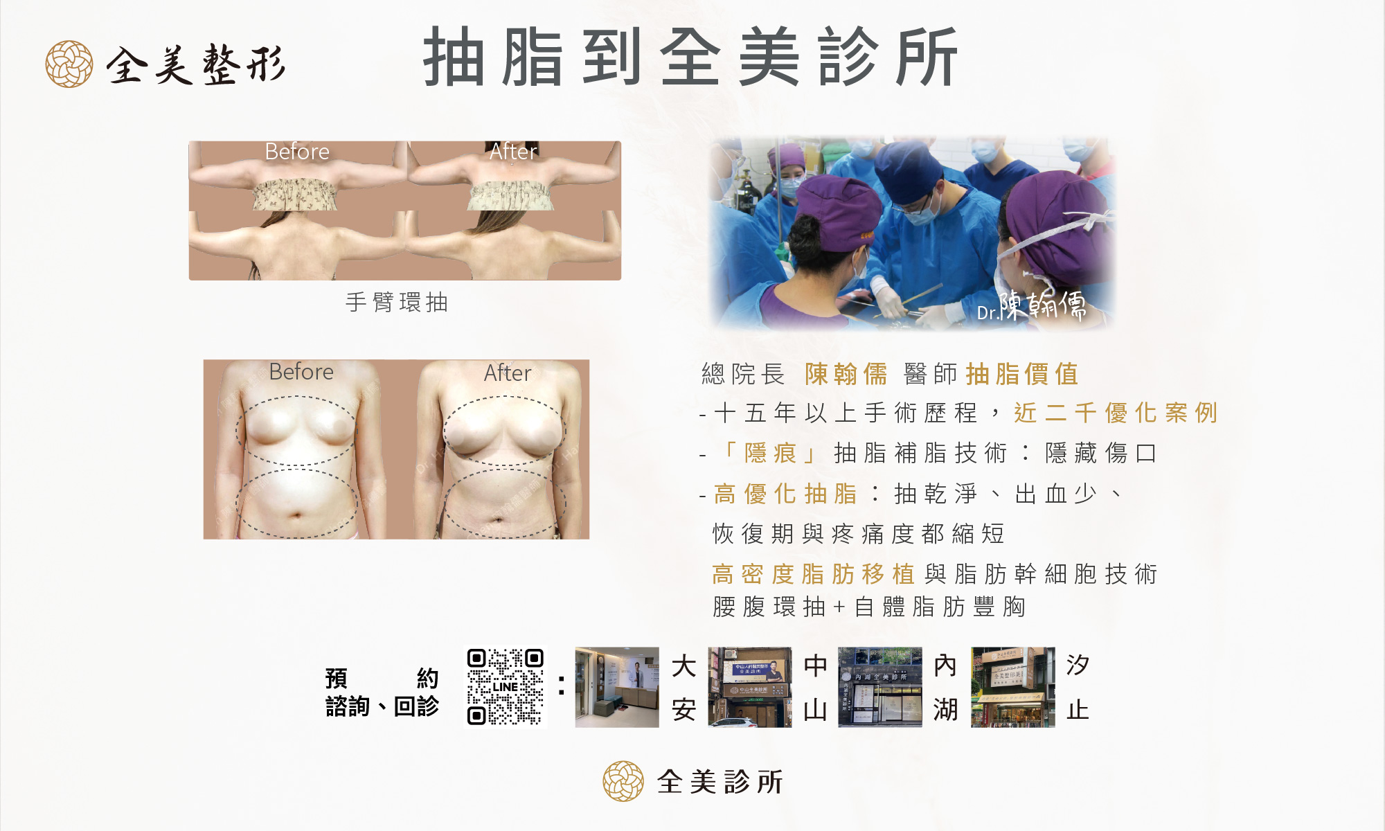 抽脂到全美診所