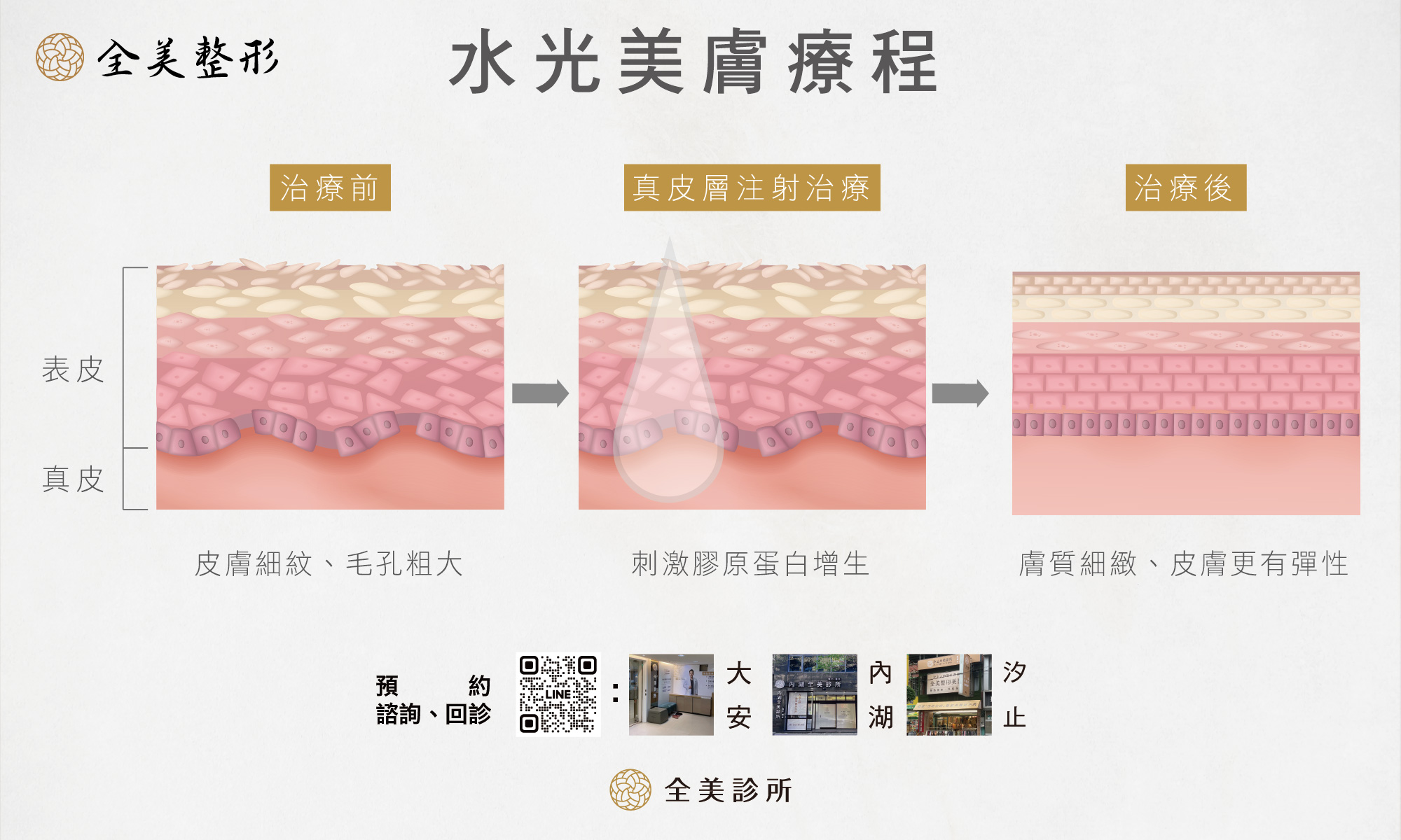 水光美膚療程_工作區域 1_0