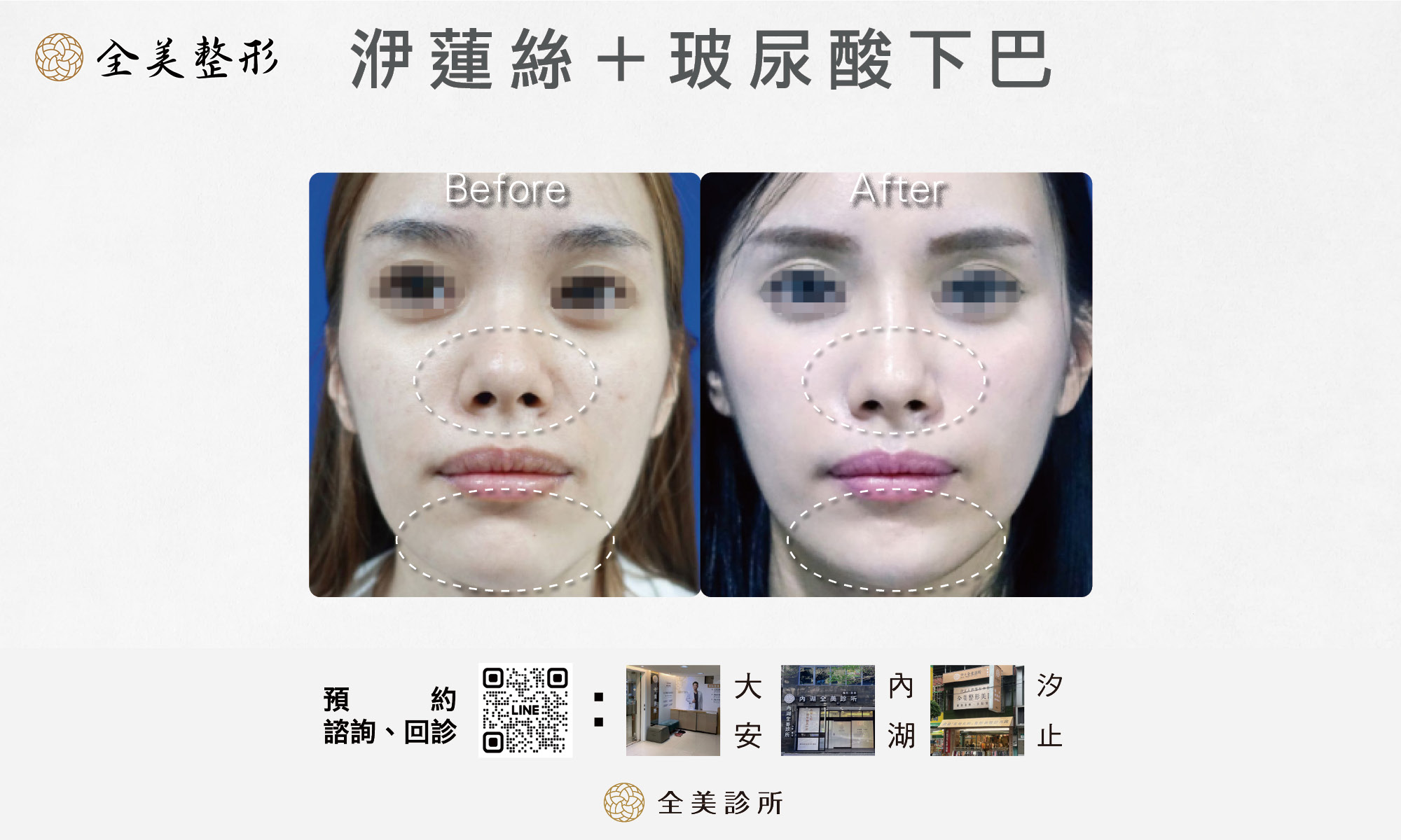 LINE_ALBUM_全美洢蓮絲_250819_1