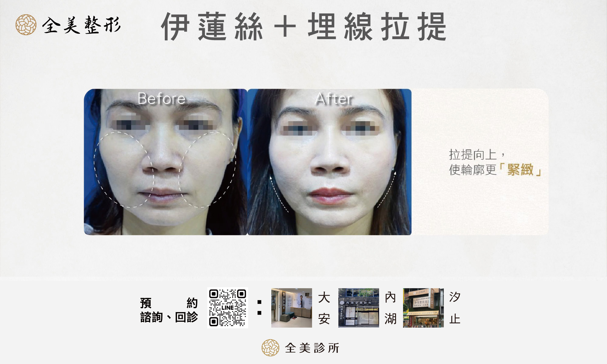 LINE_ALBUM_全美洢蓮絲_250819_2