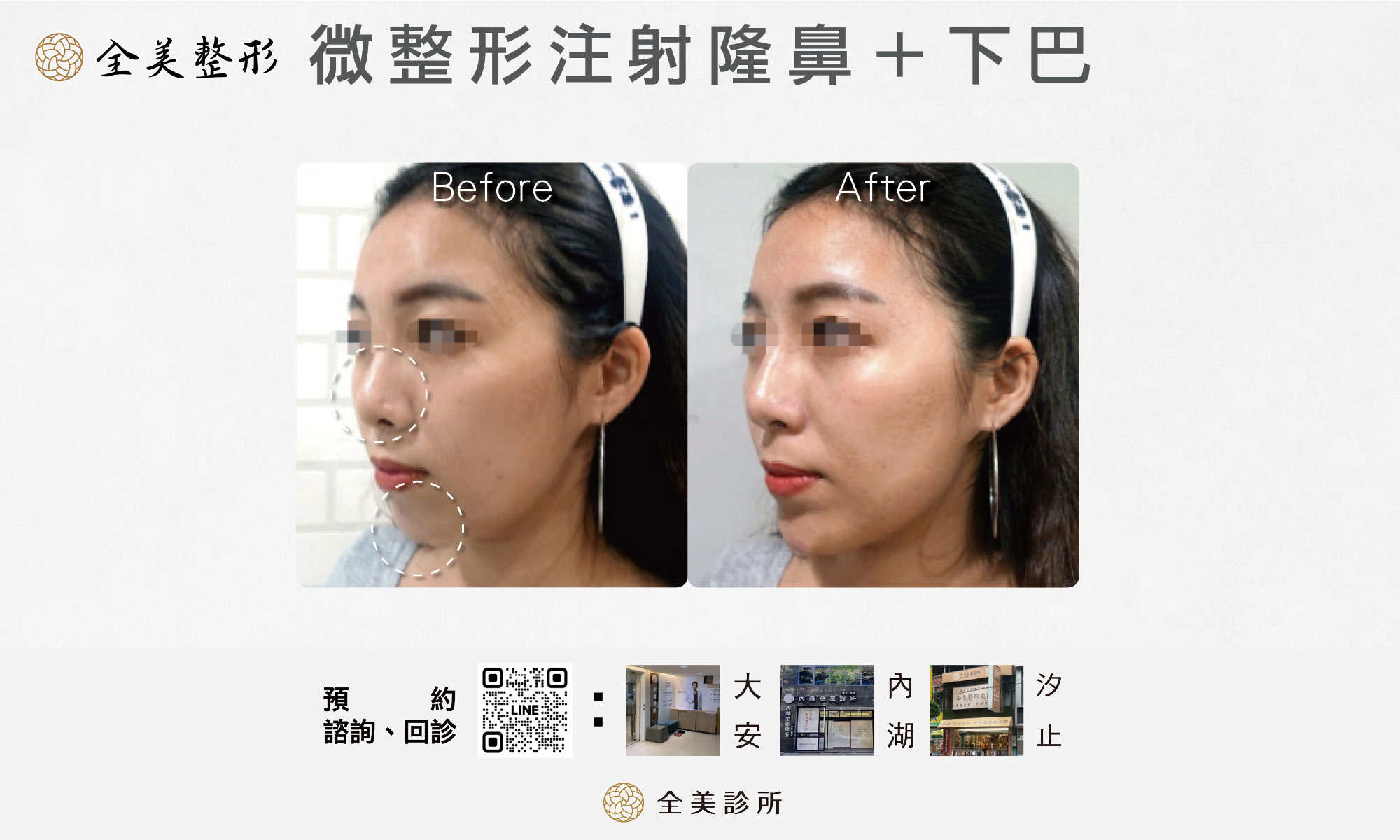 LINE_ALBUM_全美玻尿酸_250819_11