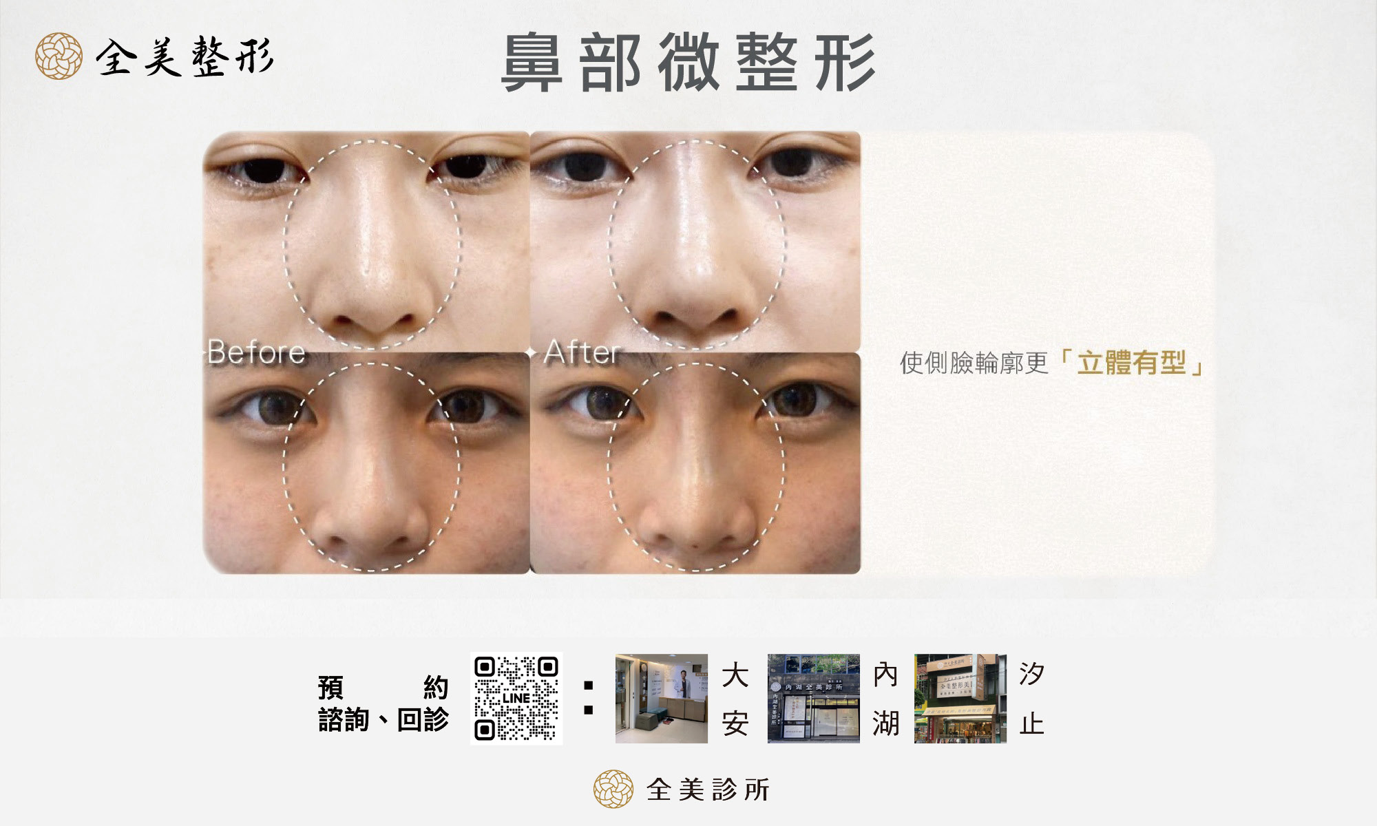 LINE_ALBUM_全美玻尿酸_250819_12