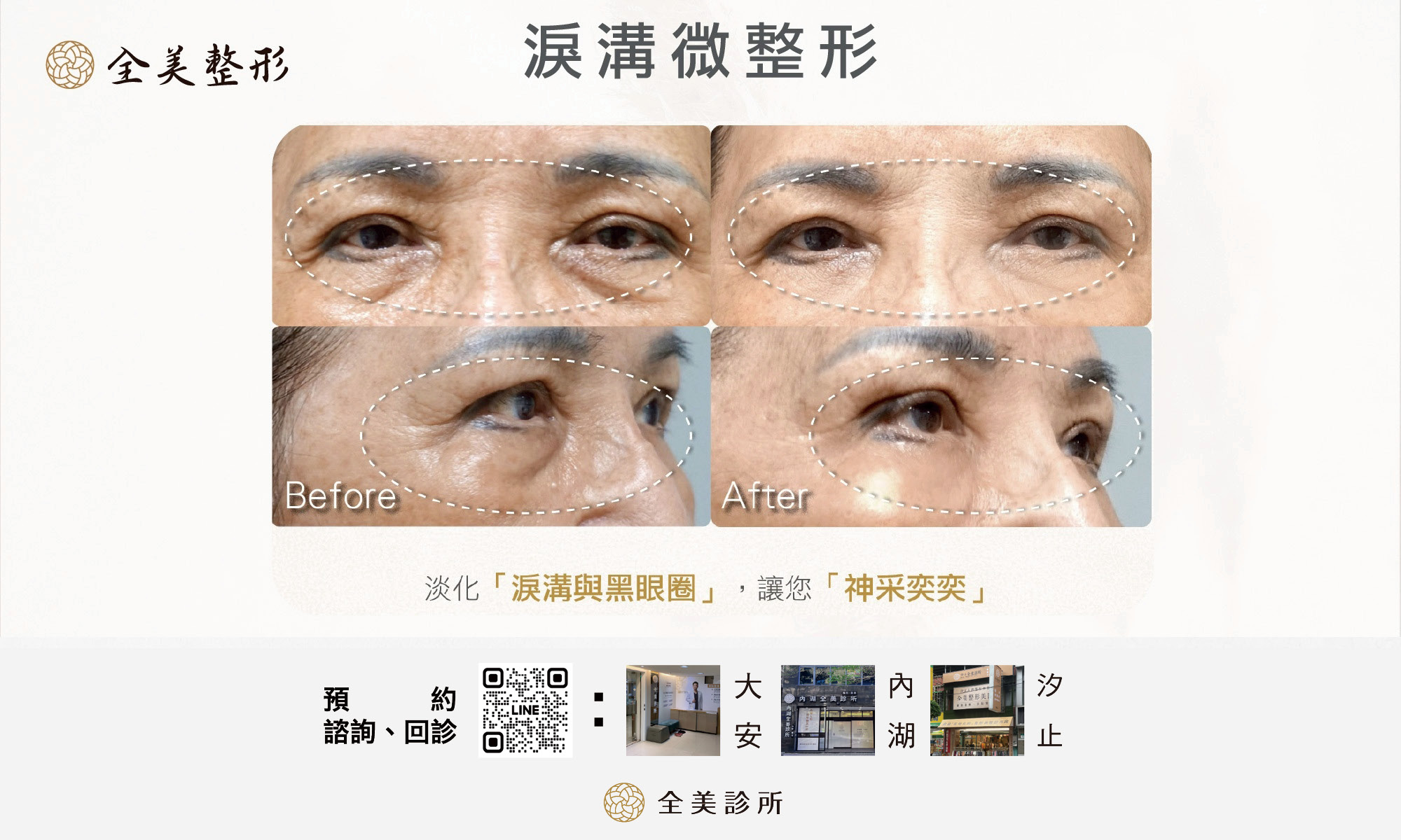 LINE_ALBUM_全美玻尿酸_250819_6