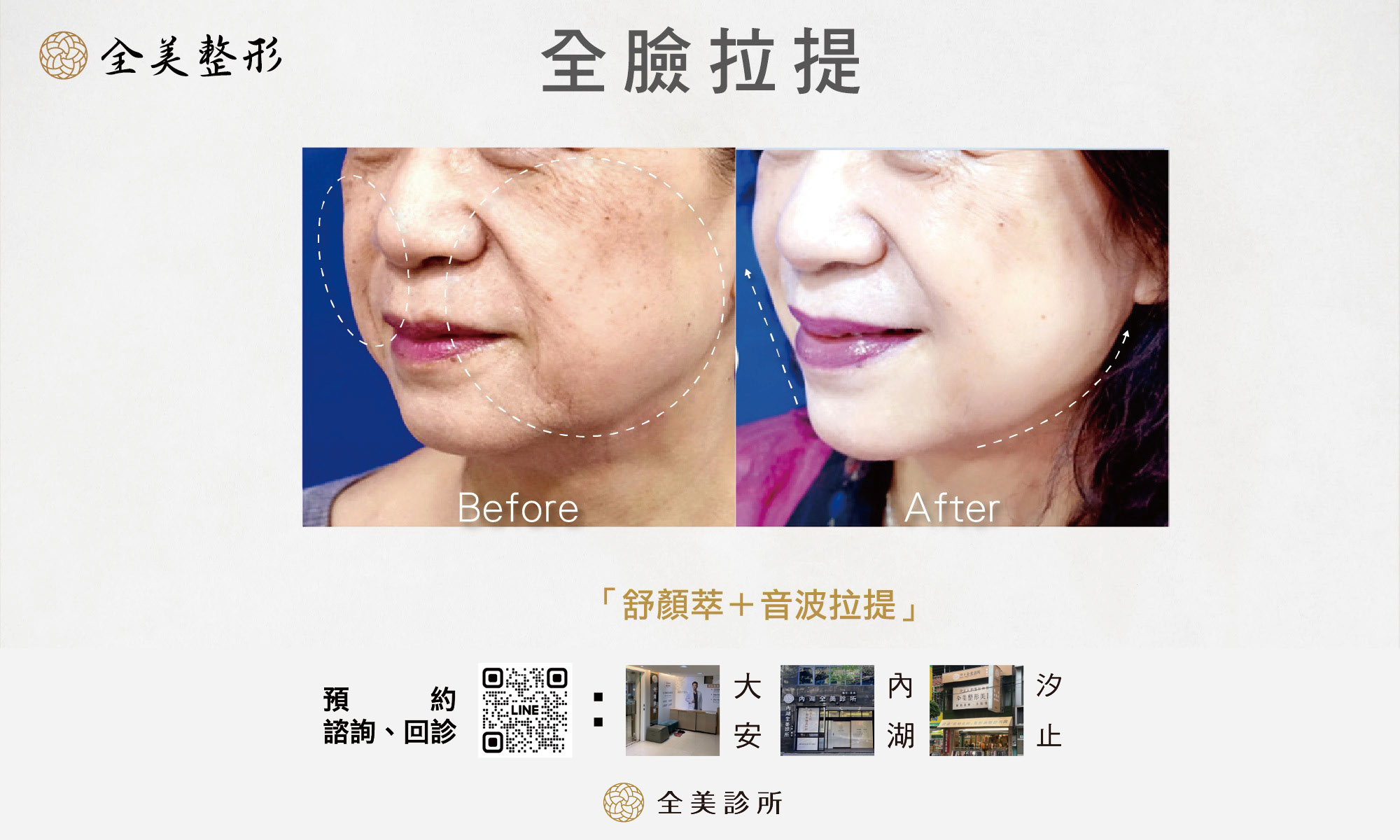 LINE_ALBUM_全美舒顏萃_250819_1