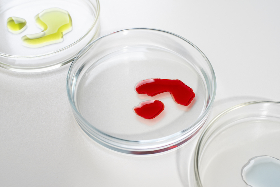 view-laboratory-test-tube-samples